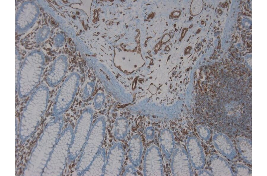 Immunohistochemistry - Anti-Vimentin Antibody [RV203] (A115652) - Antibodies.com