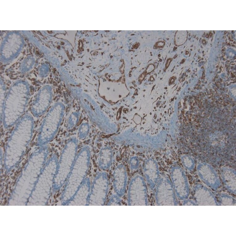 Immunohistochemistry - Anti-Vimentin Antibody [RV203] (A115652) - Antibodies.com