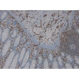 Immunohistochemistry - Anti-Vimentin Antibody [RV203] (A115652) - Antibodies.com