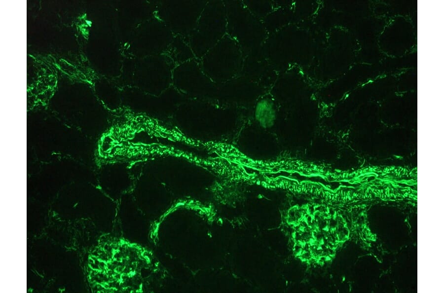 Immunohistochemistry - Anti-Vimentin Antibody [RV203] (A115652) - Antibodies.com