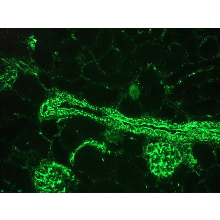 Immunohistochemistry - Anti-Vimentin Antibody [RV203] (A115652) - Antibodies.com