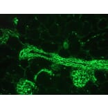 Immunohistochemistry - Anti-Vimentin Antibody [RV203] (A115652) - Antibodies.com