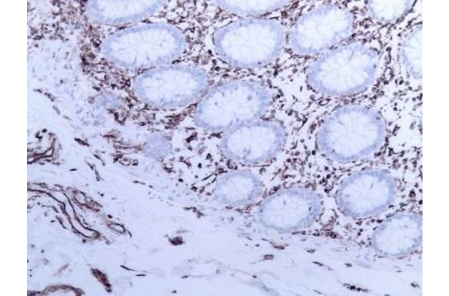 Immunohistochemistry - Anti-Vimentin Antibody [V9] (A115653) - Antibodies.com
