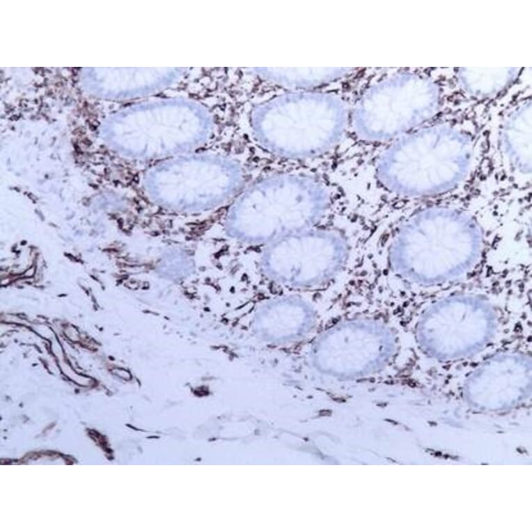 Immunohistochemistry - Anti-Vimentin Antibody [V9] (A115653) - Antibodies.com