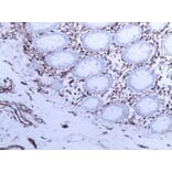 Immunohistochemistry - Anti-Vimentin Antibody [V9] (A115653) - Antibodies.com
