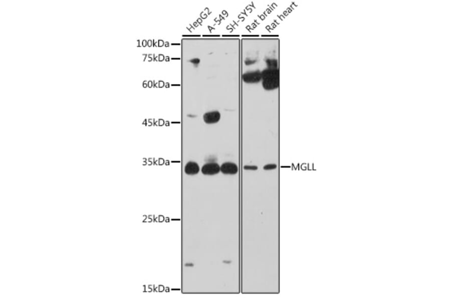 Western Blot - Anti-Monoacylglycerol Lipase/MGL Antibody (A12000) - Antibodies.com