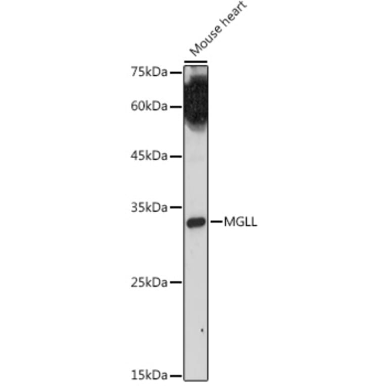 Western Blot - Anti-Monoacylglycerol Lipase/MGL Antibody (A12000) - Antibodies.com