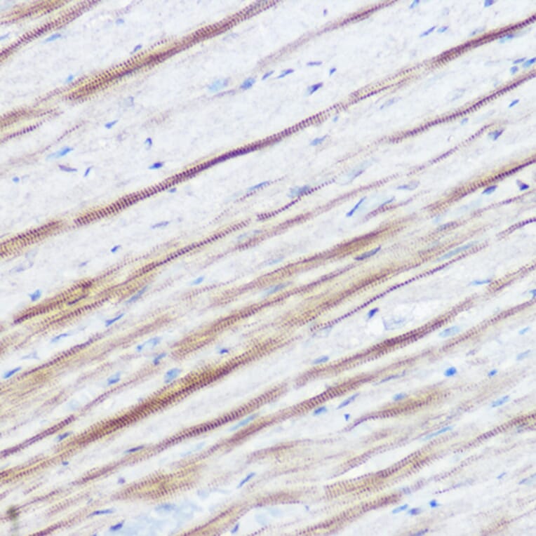 Immunohistochemistry - Anti-Monoacylglycerol Lipase/MGL Antibody (A12000) - Antibodies.com