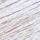 Immunohistochemistry - Anti-Monoacylglycerol Lipase/MGL Antibody (A12000) - Antibodies.com