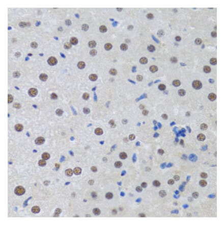 Immunohistochemistry - Anti-MTA3 Antibody (A12001) - Antibodies.com