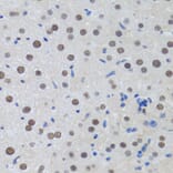 Immunohistochemistry - Anti-MTA3 Antibody (A12001) - Antibodies.com