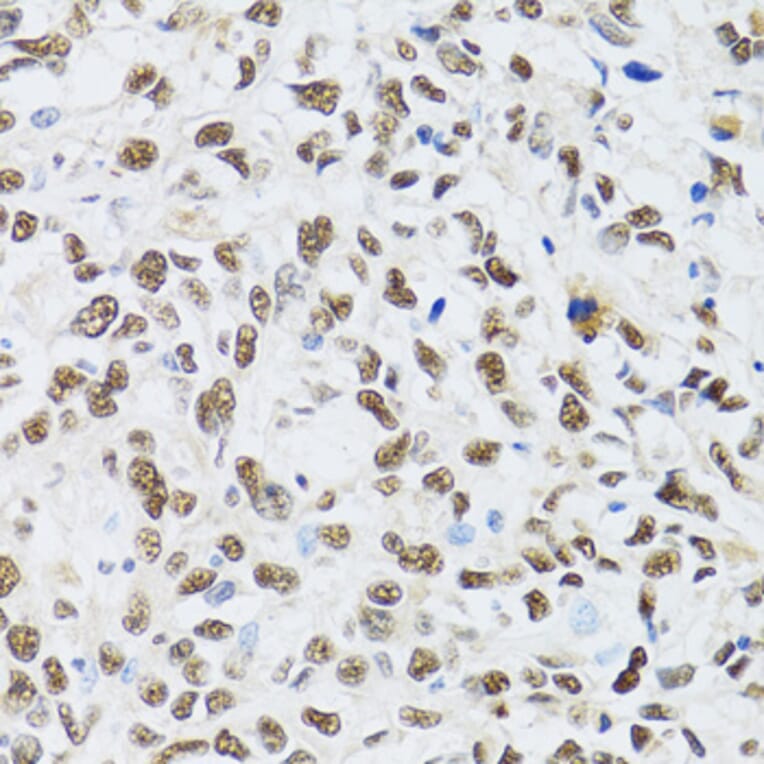 Immunohistochemistry - Anti-MTA3 Antibody (A12001) - Antibodies.com