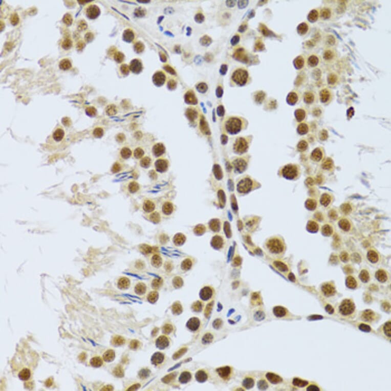 Immunohistochemistry - Anti-MTA3 Antibody (A12001) - Antibodies.com