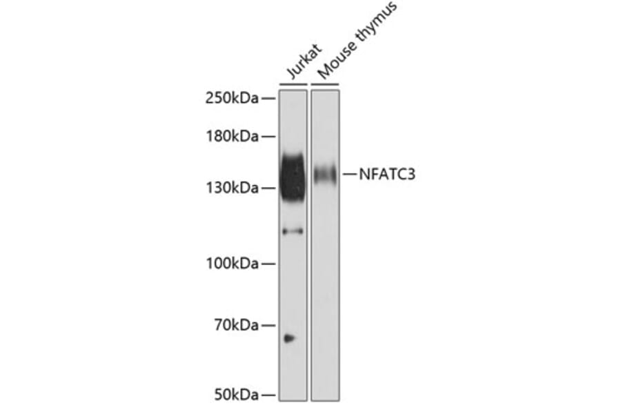 Western Blot - Anti-NFAT4/NF-ATc3 Antibody (A12002) - Antibodies.com