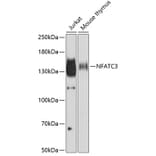 Western Blot - Anti-NFAT4/NF-ATc3 Antibody (A12002) - Antibodies.com