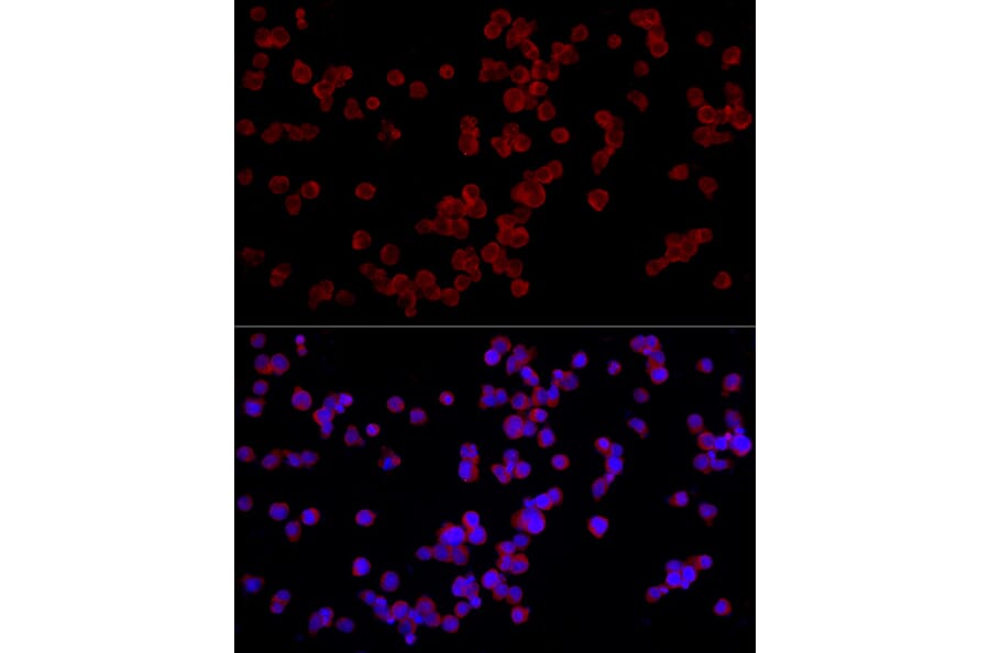 Immunofluorescence - Anti-NFAT4/NF-ATc3 Antibody (A12002) - Antibodies.com