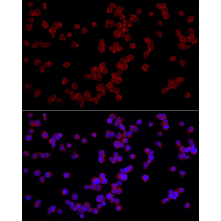 Immunofluorescence - Anti-NFAT4/NF-ATc3 Antibody (A12002) - Antibodies.com