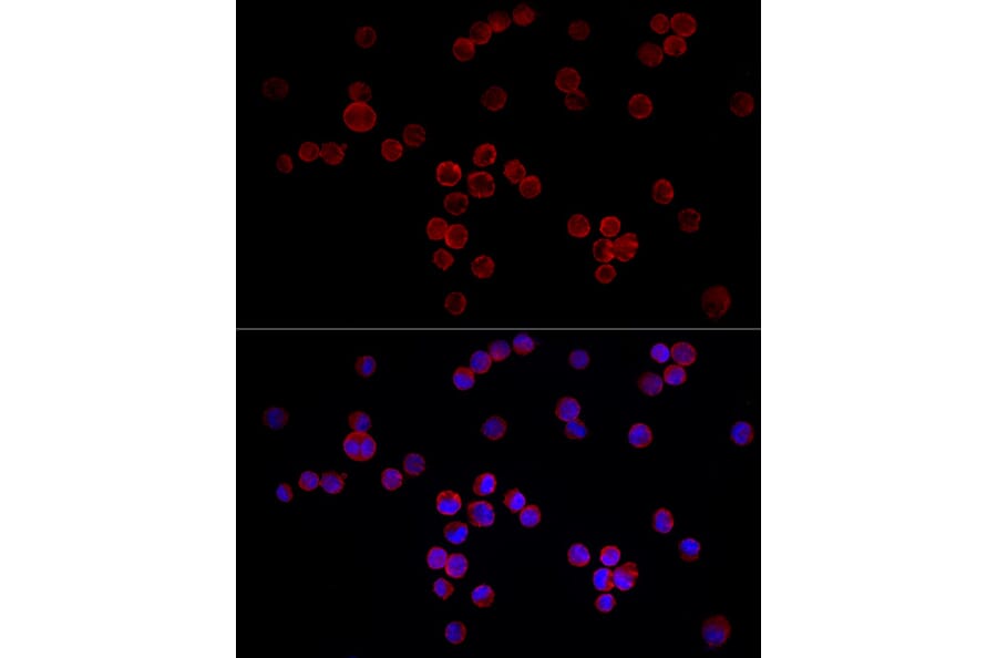 Immunofluorescence - Anti-NFAT4/NF-ATc3 Antibody (A12002) - Antibodies.com