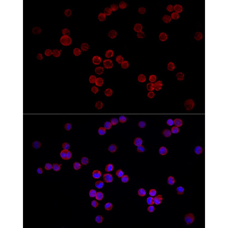 Immunofluorescence - Anti-NFAT4/NF-ATc3 Antibody (A12002) - Antibodies.com