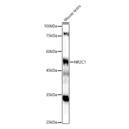 Western Blot - Anti-NR2C1 Antibody (A12003) - Antibodies.com