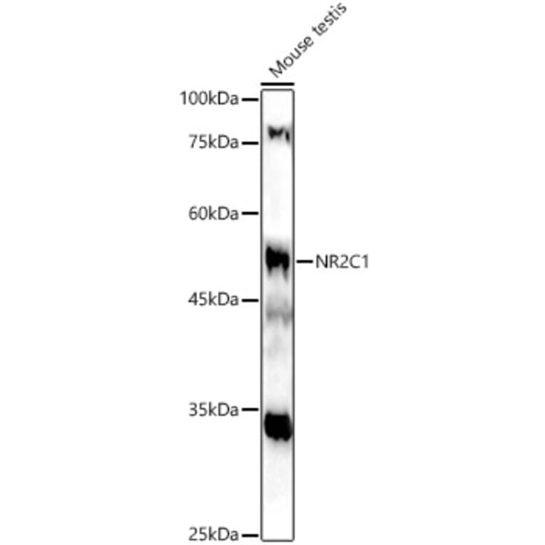 Western Blot - Anti-NR2C1 Antibody (A12003) - Antibodies.com