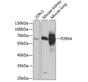 Western Blot - Anti-P2X4 Antibody (A12004) - Antibodies.com