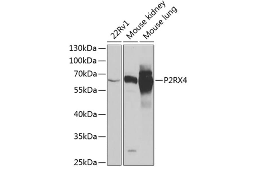 Western Blot - Anti-P2X4 Antibody (A12004) - Antibodies.com