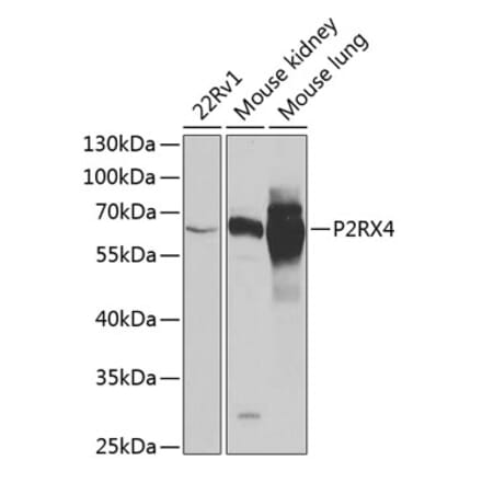 Western Blot - Anti-P2X4 Antibody (A12004) - Antibodies.com