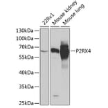 Western Blot - Anti-P2X4 Antibody (A12004) - Antibodies.com