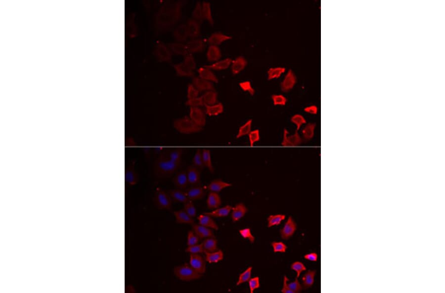 Immunofluorescence - Anti-P2X4 Antibody (A12004) - Antibodies.com