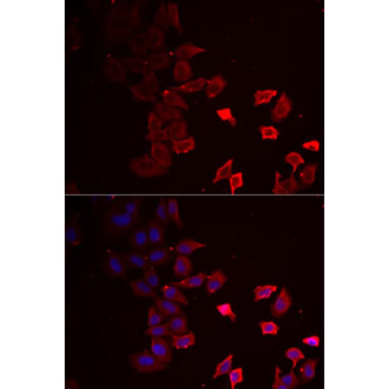 Immunofluorescence - Anti-P2X4 Antibody (A12004) - Antibodies.com