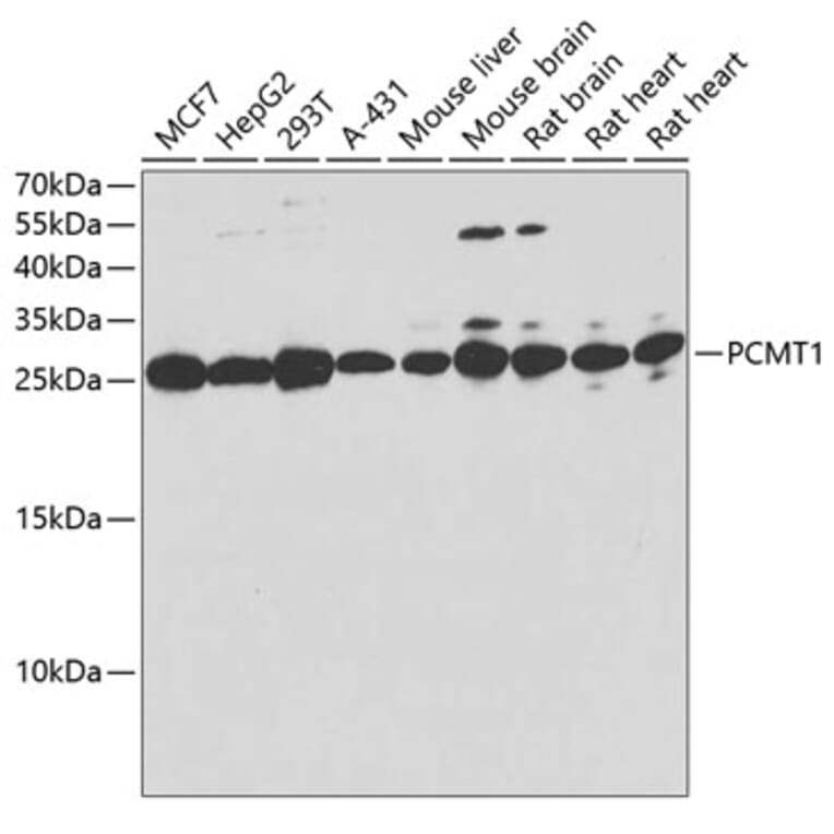 Western Blot - Anti-PCMT1 Antibody (A12005) - Antibodies.com