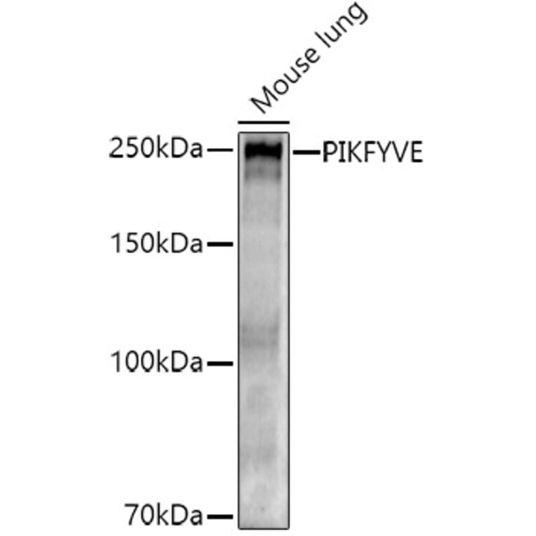 Western Blot - Anti-PIP5K3/PIKFYVE Antibody (A12006) - Antibodies.com
