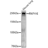 Western Blot - Anti-PIP5K3/PIKFYVE Antibody (A12006) - Antibodies.com