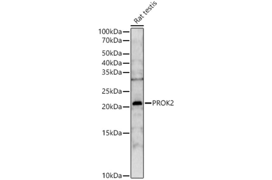 Western Blot - Anti-Prokineticin 2/PK2 Antibody (A12007) - Antibodies.com