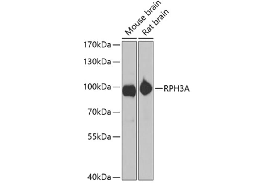 Western Blot - Anti-Rabphilin 3A Antibody (A12008) - Antibodies.com