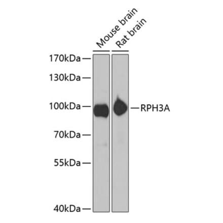 Western Blot - Anti-Rabphilin 3A Antibody (A12008) - Antibodies.com