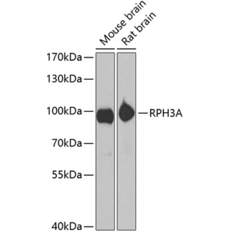 Western Blot - Anti-Rabphilin 3A Antibody (A12008) - Antibodies.com