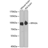 Western Blot - Anti-Rabphilin 3A Antibody (A12008) - Antibodies.com