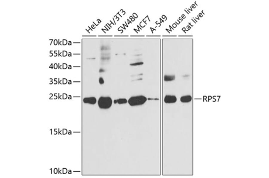 Western Blot - Anti-RPS7 Antibody (A12009) - Antibodies.com