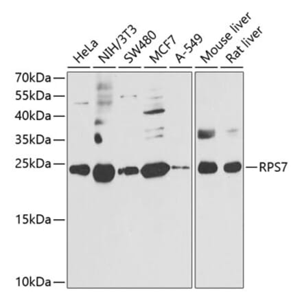 Western Blot - Anti-RPS7 Antibody (A12009) - Antibodies.com