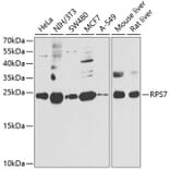 Western Blot - Anti-RPS7 Antibody (A12009) - Antibodies.com