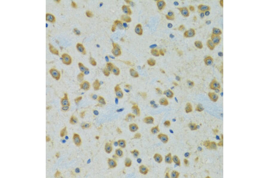 Immunohistochemistry - Anti-RPS7 Antibody (A12009) - Antibodies.com