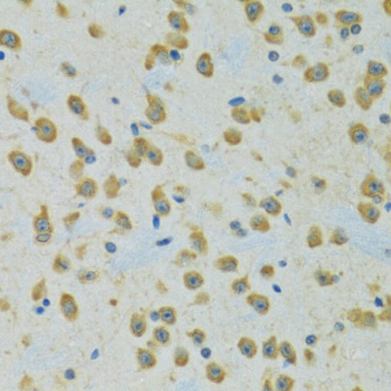 Immunohistochemistry - Anti-RPS7 Antibody (A12009) - Antibodies.com