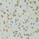 Immunohistochemistry - Anti-RPS7 Antibody (A12009) - Antibodies.com