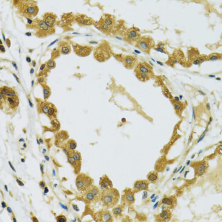 Immunohistochemistry - Anti-RPS7 Antibody (A12009) - Antibodies.com