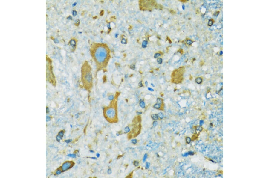 Immunohistochemistry - Anti-RPS7 Antibody (A12009) - Antibodies.com