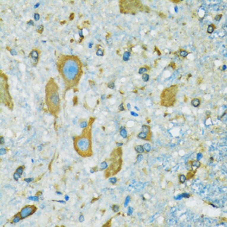 Immunohistochemistry - Anti-RPS7 Antibody (A12009) - Antibodies.com