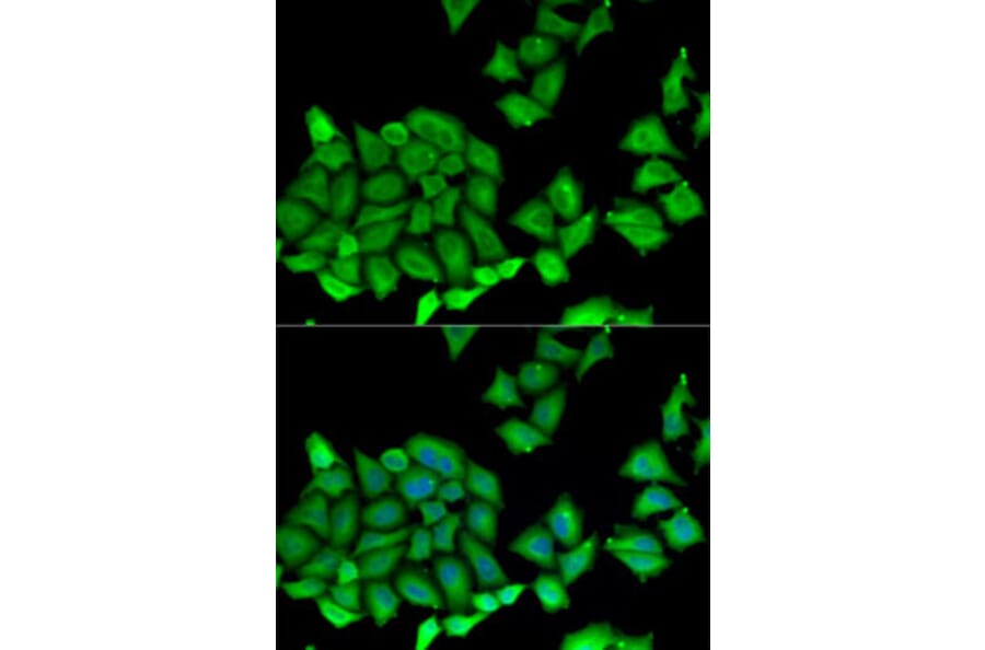 Immunofluorescence - Anti-RPS7 Antibody (A12009) - Antibodies.com