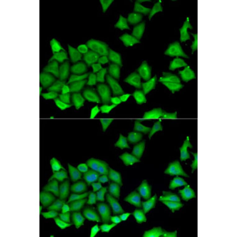 Immunofluorescence - Anti-RPS7 Antibody (A12009) - Antibodies.com